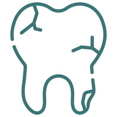 fracturas dentales
