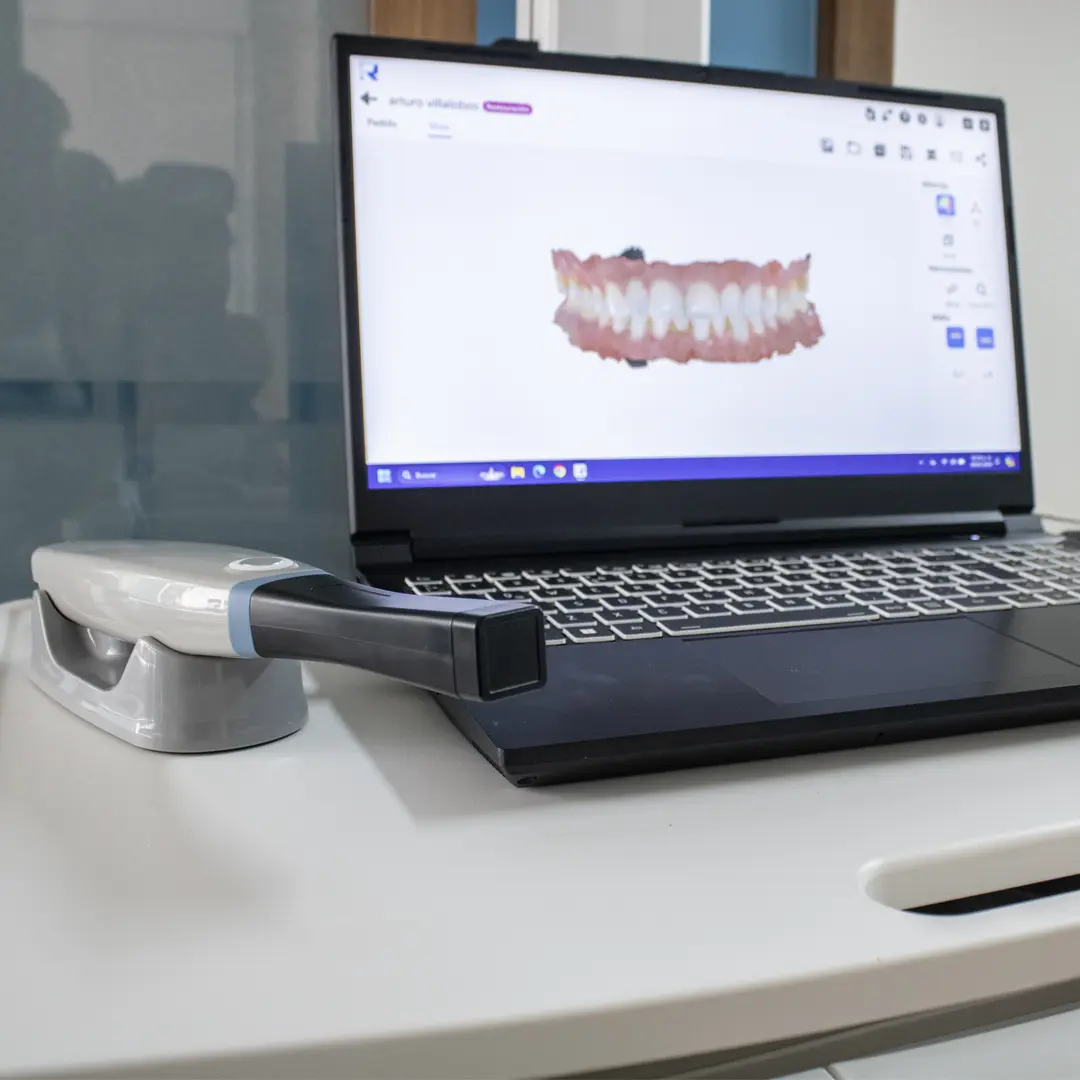 mym dental diagnóstico digital